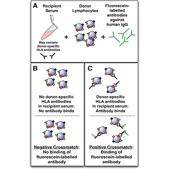 HLA Cadaveric Crossmatch